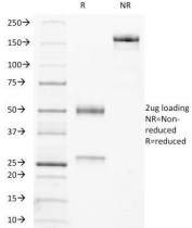 SDS-PAGE Analysis of Purified, BSA-Free TRAcP Antibody (ACP5/1070). Confirmation of Integrity and Purity of the Antibody.