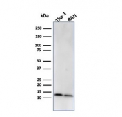 Western blot testing of human ThP-1 and Raji cell lysate with Beta-2 Microglobulin antibody (clone BBM.1). Expected molecular weight: 12-14 kDa.