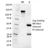 SDS-PAGE Analysis of Purified, BSA-Free Parathyroid Hormone Antibody (clone 3H9). Confirmation of Integrity and Purity of the Antibody.