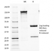 SDS-PAGE Analysis of Purified, BSA-Free Parathyroid Hormone Antibody (clone PTH/1173). Confirmation of Integrity and Purity of the Antibody.