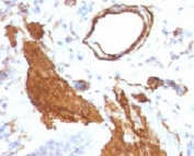 IHC: Formalin-fixed, paraffin-embedded rat lung stained with alpha Smooth Muscle Actin antibody (clone ACTA2/791).