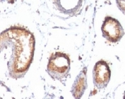 IHC: Formalin-fixed, paraffin-embedded human testis stained with PMEL17 antibody (PMEL/783).