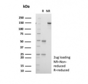 SDS-PAGE analysis of purified, BSA-free VCAM1 antibody (clone VCAM1/843) as confirmation of integrity and purity.