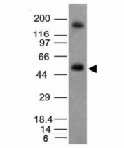 Western blot analysis of HCT116 cell lysate using CAIX antibody (CA9/781). Predicted molecular weight: 50-55 kDa but may be observed at higher molecular weights due to glycosylation.