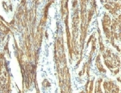 IHC: Formalin-fixed, paraffin-embedded human uterus stained with CAD antibody (CALD1/820 + h-CALD).