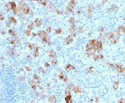 IHC testing of formalin-fixed, paraffin-embedded human Hodgkin