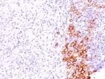 IHC: Formalin-fixed, paraffin-embedded human Hodgkin