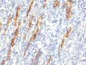 IHC: Formalin-fixed, paraffin-embedded human tonsil stained with CD34 antibody (QBEnd/10 + HPCA1/763)
