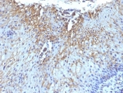 IHC: Formalin-fixed, paraffin-embedded human tongue stained with CD59 antibody (SPM616)