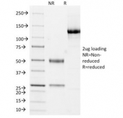 SDS-PAGE Analysis of Purified, BSA-Free Cytokeratin 10/13 Antibody (clone DE-K13). Confirmation of Integrity and Purity of the Antibody.