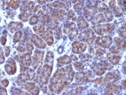 IHC: Formalin-fixed, paraffin-embedded human pancreas stained with Golgi antibody (AE-6).