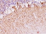 IHC: Formalin-fixed, paraffin-embedded human cerebellum stained with Neurofilament antibody (SPM145).
