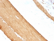 IHC: Formalin-fixed, paraffin-embedded rat stomach stained with pan Muscle Actin antibody