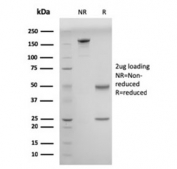 SDS-PAGE analysis of purified, BSA-free Double Stranded DNA antibody (clone DSD/958) as confirmation of integrity and purity.