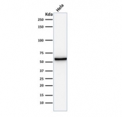 Western blot testing of human HeLa cell lysate with anti-Mitochondrial antibody (clone AE-1).