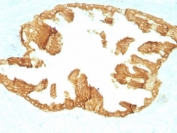 IHC: Formalin paraffin rat oviduct with Basic Cytokeratin antibody (KRTH/1076).