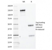 SDS-PAGE Analysis of Purified, BSA-Free Basic Cytokeratin Antibody (clone KRTH/1076). Confirmation of Integrity and Purity of the Antibody.