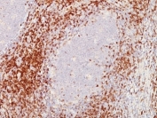 IHC: Formalin-fixed, paraffin-embedded human tonsil stained with CD5 antibody (C5/473 + CD5/54/F6)
