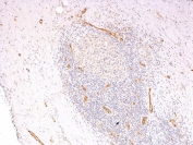 IHC: Formalin-fixed, paraffin-embedded human pancreas stained with vWF antibody cocktail (clones 3E2D10 + VWF635).