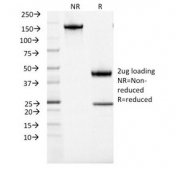 SDS-PAGE Analysis of Purified, BSA-Free ACTH Antibody (clone CLIP/1407). Confirmation of Integrity and Purity of the Antibody.
