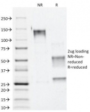 SDS-PAGE Analysis of Purified, BSA-Free Alpha Catenin Antibody (clone 1G5). Confirmation of Integrity and Purity of the Antibody.