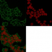 Immunofluorescent staining of human HeLa cells with Plakoglobin antibody (clone 11E4, green) and Reddot nuclear stain (red).