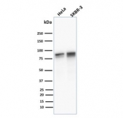 Western blot testing of human 1) HeLa and 2) SK-BR-3 cell lysate with Plakoglobin antibody (clone 11E4). Predicted molecular weight: 80-87 kDa.
