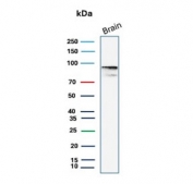 Western blot testing of human brain tissue lysate with Beta Catenin antibody (clone 12F7). Predicted molecular weight ~85 kDa, but routinely observed at 90-95 kDa.