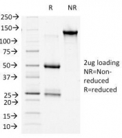 SDS-PAGE Analysis of Purified, BSA-Free b-Catenin Antibody (clone 9F2). Confirmation of Integrity and Purity of the Antibody.