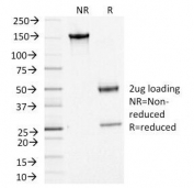 SDS-PAGE Analysis of Purified, BSA-Free ACTH Antibody (clone CLIP/1449). Confirmation of Integrity and Purity of the Antibody.