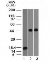 Western blot testing of 1) a partial recombinant protein, 2) human Jurkat and 3) human A549 lysate with Alpha 1 Antitrypsin antibody (clone AAT/1378). Expected molecular weight: ~47 kDa (unmodified), 52 kDa (glycosylated).