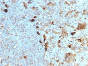 IHC testing of FFPE human tonsil with Alpha 1 Antitrypsin antibody (clone AAT/1378). Required HIER: steam sections in pH6, 10mM citrate buffer for 10-20 min.