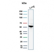 Western blot testing of human lung tissue lysate with Alpha 1 Antitrypsin antibody. Expected molecular weight: 47-52 kDa depending on the level of glycosylation.
