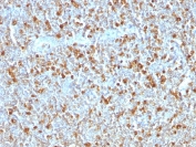 IHC testing of FFPE human tonsil with Alpha 1 Antitrypsin antibody (clone AAT/1379). Required HIER: steam sections in pH6, 10mM citrate buffer for 10-20 min.