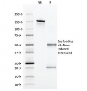 SDS-PAGE Analysis of Purified, BSA-Free Alpha 1 Antitrypsin Antibody (clone AAT/1379). Confirmation of Integrity and Purity of the Antibody.