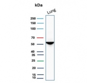 Western blot testing of human lung tissue lysate with Alpha 1 Antitrypsin antibody. Expected molecular weight: 47-52 kDa depending on the level of glycosylation.