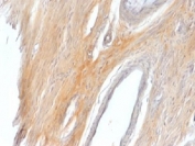 IHC testing of FFPE rat uterus with recombinant Caldesmon antibody. Required HIER: boil tissue sections in 1mM EDTA, pH 7.5-8.5, for 10-20 min.