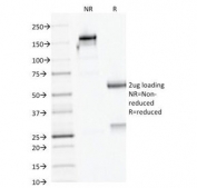 SDS-PAGE analysis of purified, BSA-free AMACR antibody  (clone AMACR/1723) as confirmation of integrity and purity.