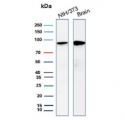 Western blot testing of mouse NIH 3T3 and human brain tissue lysate with Beta Catenin antibody (clone 15B8). Predicted molecular weight ~85 kDa, but routinely observed at 90-95 kDa.