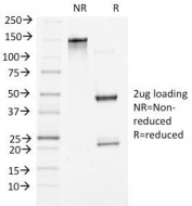 SDS-PAGE Analysis of Purified, BSA-Free Beta Catenin Antibody (clone 5H10). Confirmation of Integrity and Purity of the Antibody.