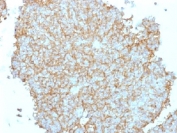 IHC testing of FFPE human Ewing
