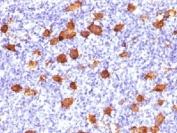 IHC testing of FFPE human Hodgkin