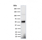 Western blot testing of human Raji cell lysate with CD79a antibody (clone HM57). Expected molecular weight: 25-47 kDa depending on glycosylation level.