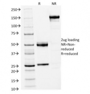 SDS-PAGE Analysis of Purified, BSA-Free FOXA1 Antibody (clone FOXA1/1512). Confirmation of Integrity and Purity of the Antibody.