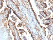 IHC testing of FFPE human placenta with Galectin 13 antibody (clone PP13/1161). Required HIER: boil tissue sections in 10mM Tris with 1mM EDTA, pH 9 or 10mM Citrate buffer, pH 6, for 10-20.