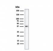 Western blot testing of human heart lysate with Histone H1 antibody. Observed molecular weight ~22/30-33 kDa (unmodified/modified).