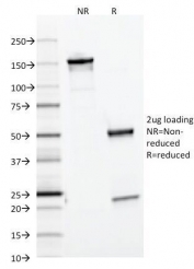 SDS-PAGE analysis of purified, BSA-free Ferritin Light Chain antibody (clone FTL/1386) as confirmation of integrity and purity.