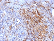 IHC staining of FFPE human pancreas with Ferritin Light Chain antibody (clone FTL/1386). HIER: boil tissue sections in pH 9 10mM Tris with 1mM EDTA for 10-20 min and allow to cool before testing.