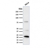 Western blot testing of human HeLa lysate with Ferritin Light Chain antibody. Predicted molecular weight: ~20 kDa.