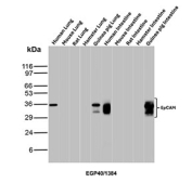 Western blot testing of human, mouse, rat, hamster and guinea pig tissue lysate samples with EpCAM antibody. Expected molecular weight: ~35 kDa (unmodified), 40-43 kDa (glycosylated).